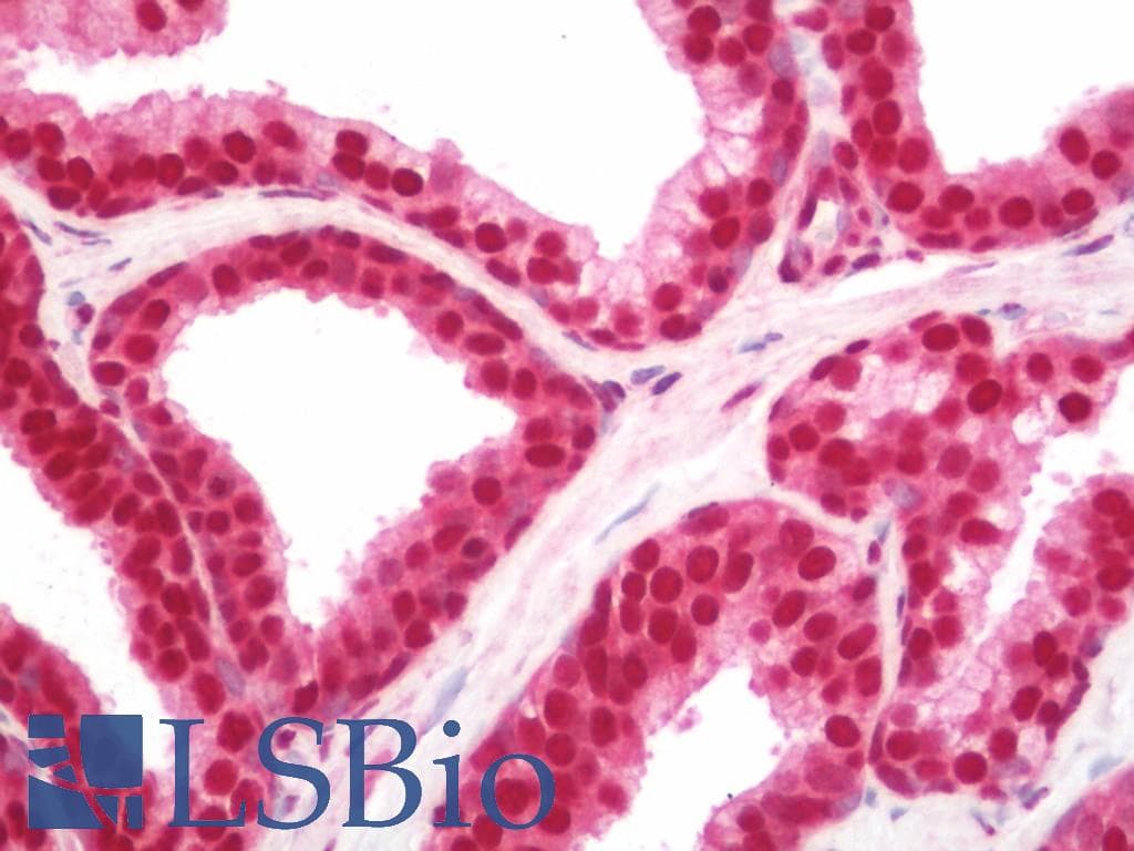 IHC-plus™ Polyclonal Rabbit anti-Human IKZF2 / HELIOS Antibody (aa25-75, IHC, WB)