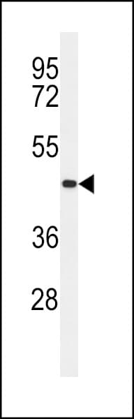 Polyclonal Rabbit anti-Human TMEM30B Antibody (aa42-71, IHC, WB)