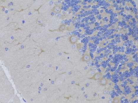 Polyclonal Rabbit anti-Human RARA / RAR Alpha Antibody (IHC, WB)