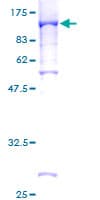 Human STAT4 Protein (Recombinant GST)