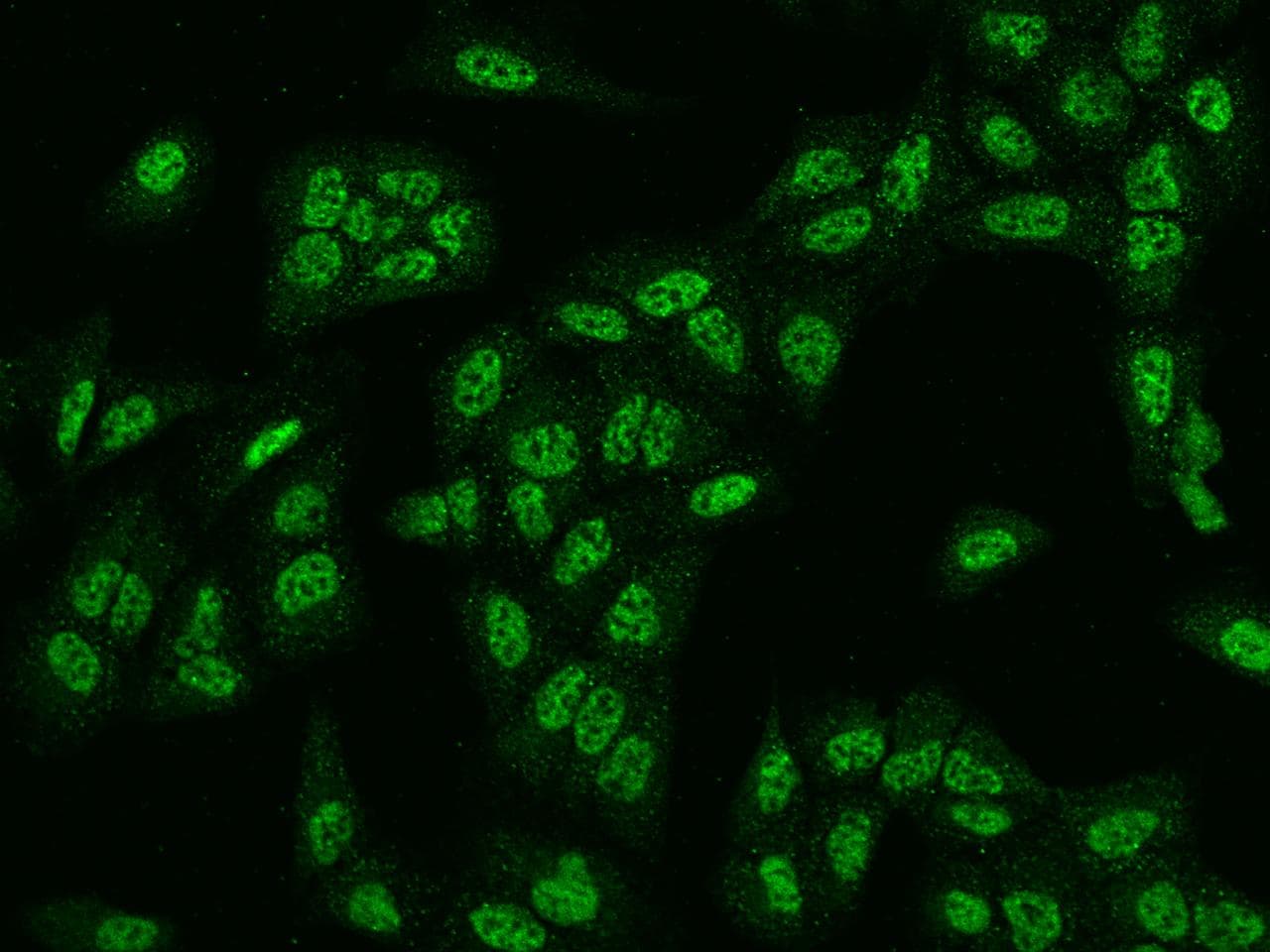 RAD1 Antibody