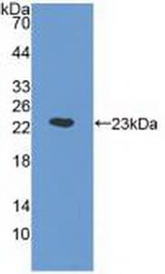 ORM1 / Orosomucoid Antibody (Biotin)