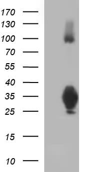 CD74 / CLIP Antibody (clone OTI1G10, Carrier-free)