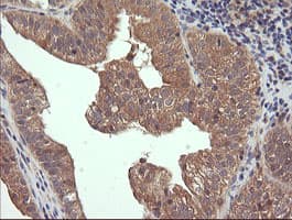 Monoclonal Mouse anti-Human TCL / RHOJ Antibody (clone OTI2C10, IHC, IF, WB)