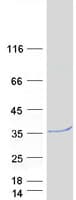 Human SDR39U1 Protein (Recombinant Myc-DDK (Flag))