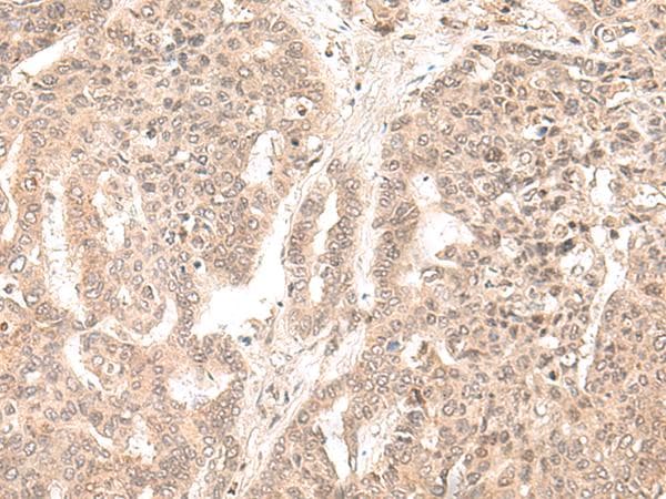 EXOSC9 / p5 Antibody