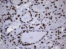 NBN / Nibrin Antibody (clone OTI7D5)