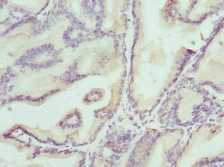 Polyclonal Rabbit anti-Human KLK4 / Kallikrein 4 Antibody (IHC)