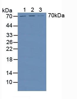 HPSE / Heparanase Antibody (aa34-115)