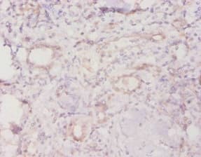 TROVE2 Antibody