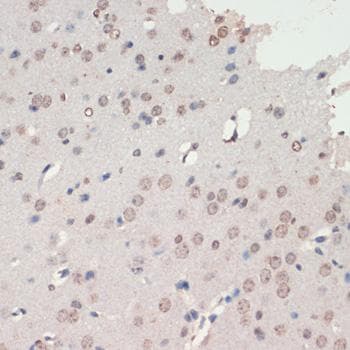 Polyclonal Rabbit anti-Human NEUROD1 Antibody (IHC)