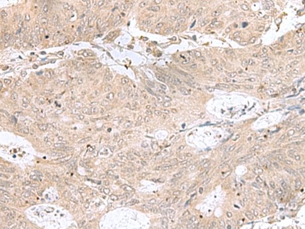 Polyclonal Rabbit anti-Human RPL35 / Ribosomal Protein L35 Antibody (IHC)