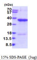 Human MICA Protein (Recombinant His)