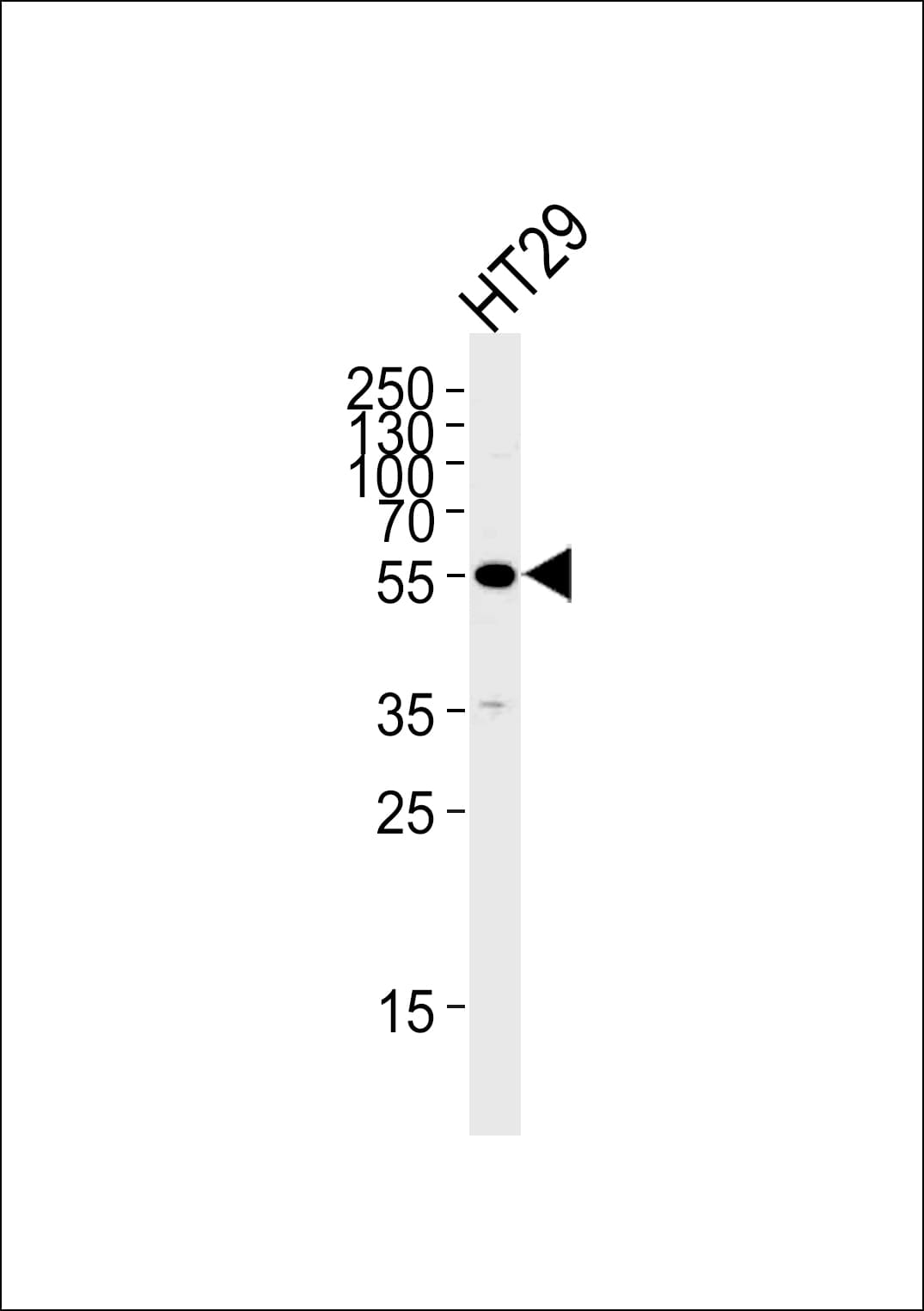 TP53 / p53 Antibody (N-Terminus, clone 1227CT355.106.153)