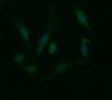 LGALS3 / Galectin 3 Antibody (clone OTI1A3)