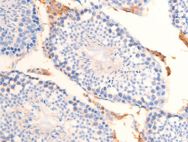 CHEK2 / CHK2 Antibody (phospho-Thr68)
