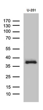 DTWD1 Antibody (clone OTI1D2)
