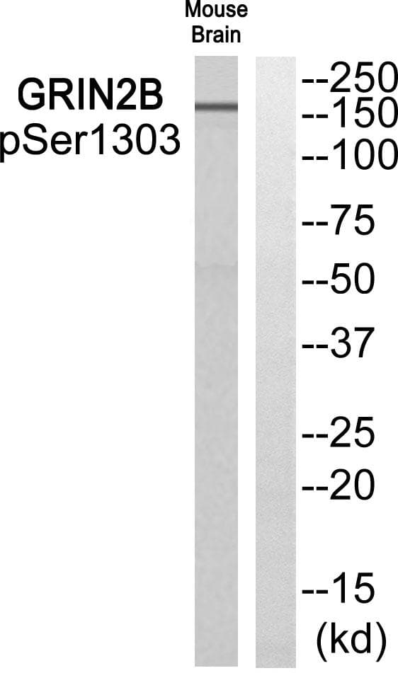 GRIN2B / NMDAR2B / NR2B Antibody (phospho-Ser1303)