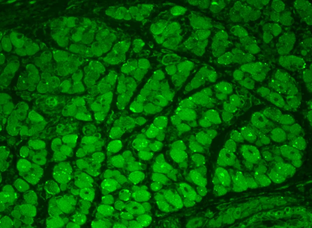 CAMK2 / CAMKII Antibody (phospho-Thr286/Thr287, clone 22B1)