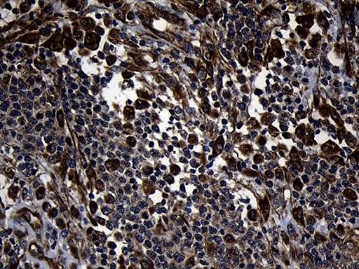FBXO25 Antibody (aa1-191, clone OTI6F11)