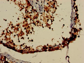 NR0B1 / DAX1 Antibody