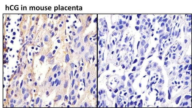 hCG / Chorionic Gonadotropin Antibody (clone SC1)