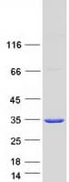 Human SULT1A1 / Sulfotransferase 1A1 Protein (Recombinant Myc-DDK (Flag))