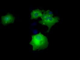 DAPK2 / DAP Kinase 2 Antibody (clone OTI1F7, Carrier-free)