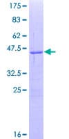 Human SMO / Smoothened Protein (Recombinant GST, N-terminus)