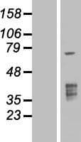 TMPRSS3 Protein (Over-Expression Lysate Myc-DDK (Flag))