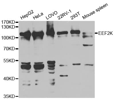 Polyclonal Rabbit anti-Human EEF2K Antibody (IHC, IF, WB)