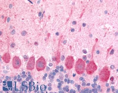 IHC-plus™ OX1R / Orexin Receptor 1 Antibody (Extracellular Domain)