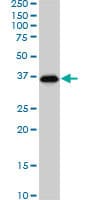 IHC-plus™ SMAD3 Antibody (clone 7F3)