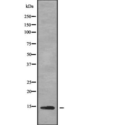 DYNLT1 / TCTEX-1 Antibody