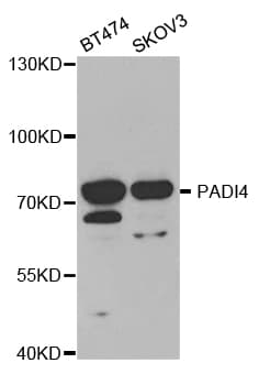 Polyclonal Rabbit anti-Human PADI4 / PAD4 Antibody (WB)