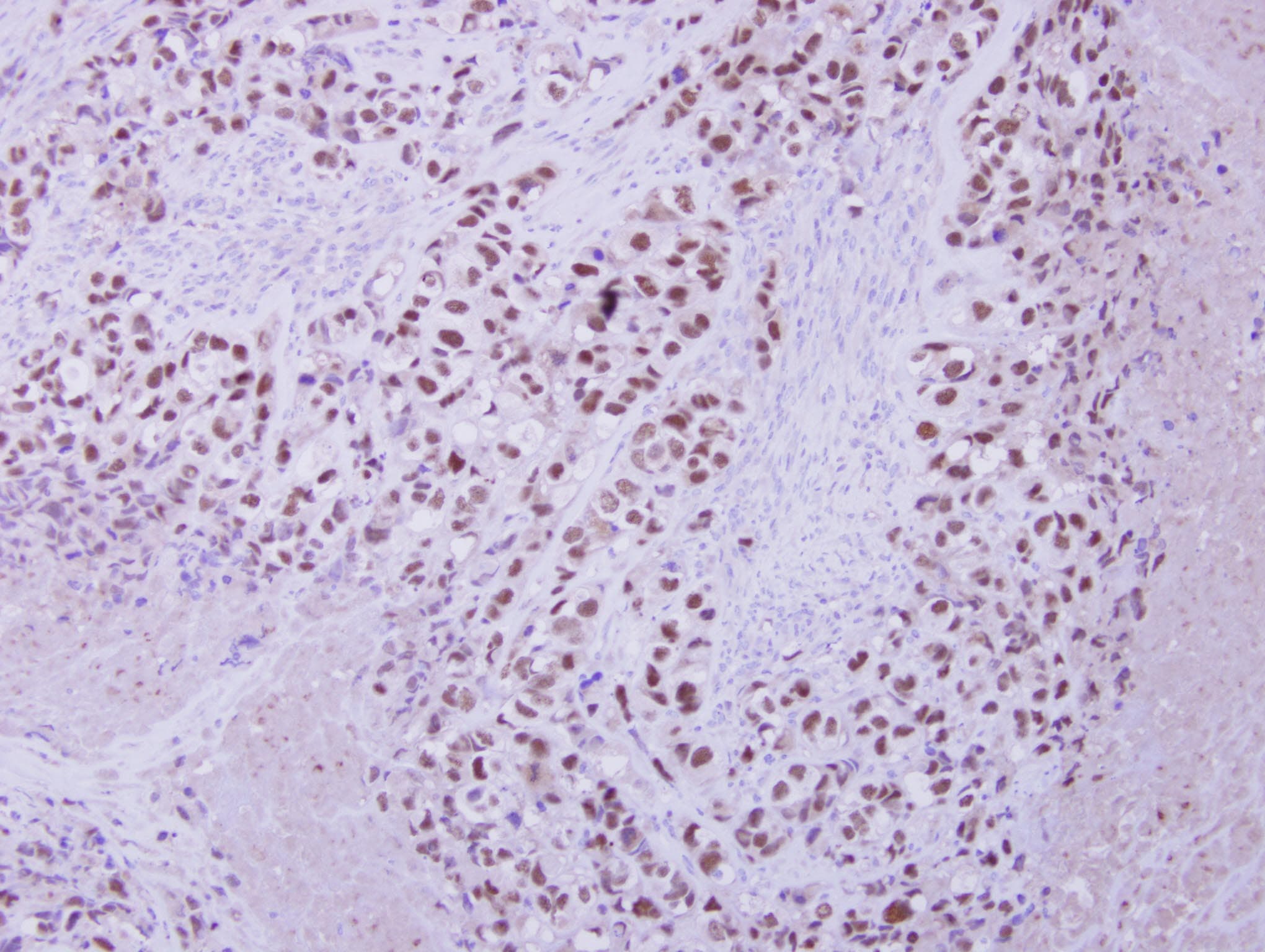 Polyclonal Rabbit anti-Human ZNF217 Antibody (Internal, IHC, WB)