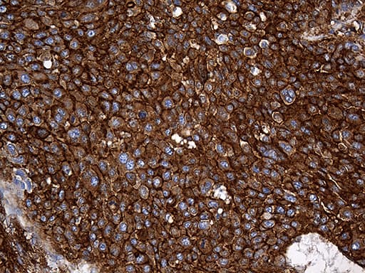 SPTAN1 / Alpha Fodrin Antibody (aa1-147, clone OTI9C10)