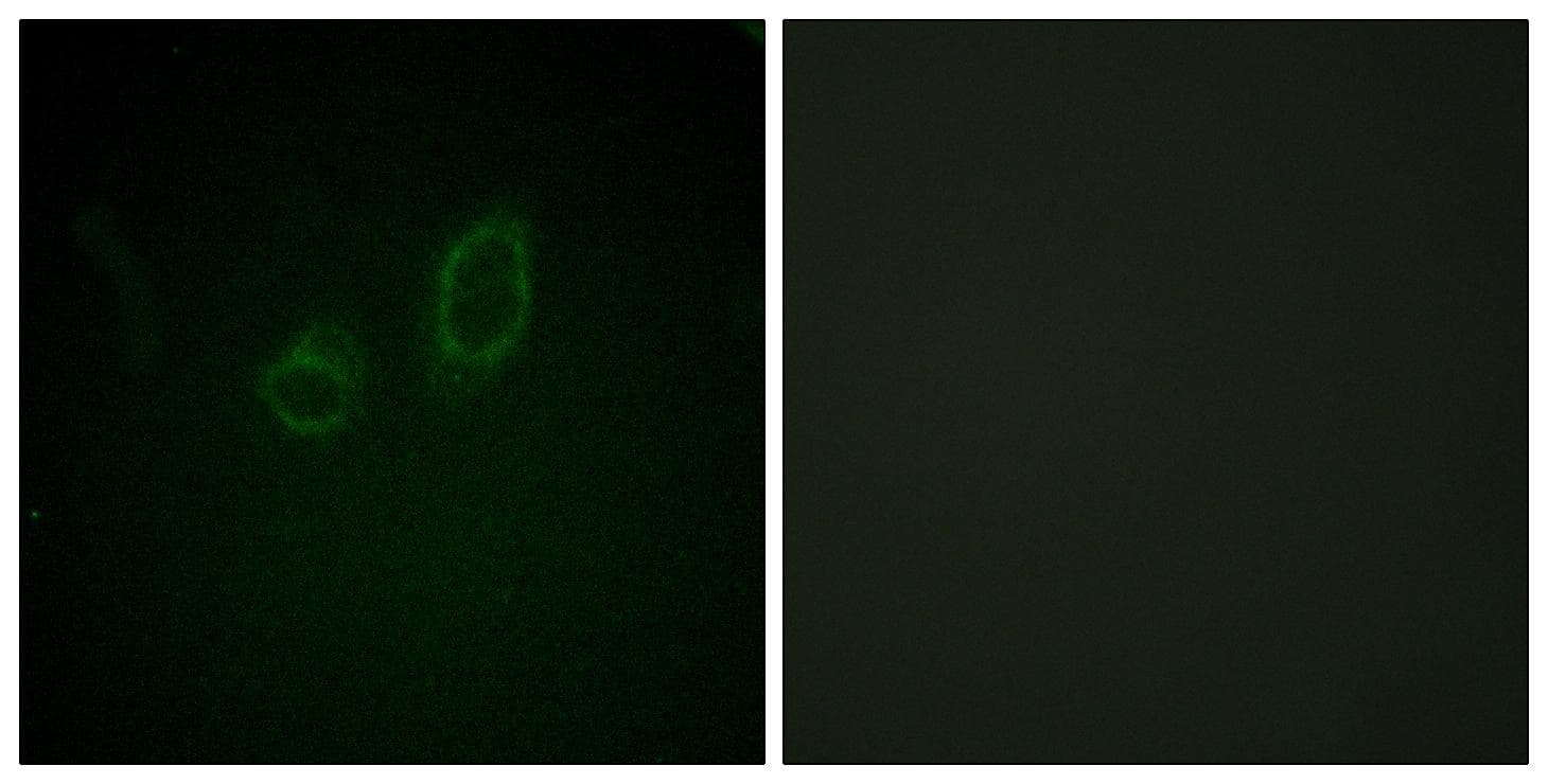 Polyclonal Rabbit anti-Human MSN / Moesin Antibody (phospho-Thr558, IHC, IF, WB)