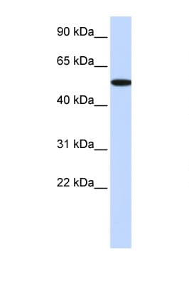 RICK / RIP2 Antibody (C-Terminus)