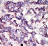 PDK2 Antibody (aa378-407)
