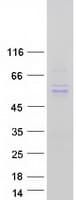Human TINAGL1 / Lipocalin 7 Protein (Recombinant Myc-DDK (Flag))
