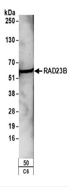 Polyclonal Rabbit anti-Human RAD23B / HR23B Antibody (aa359-409, IHC, WB)