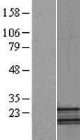 NDUFB5 Protein (Over-Expression Lysate Myc-DDK (Flag))