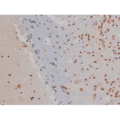 IGF1R / IGF1 Receptor Antibody (phospho-Tyr1346)