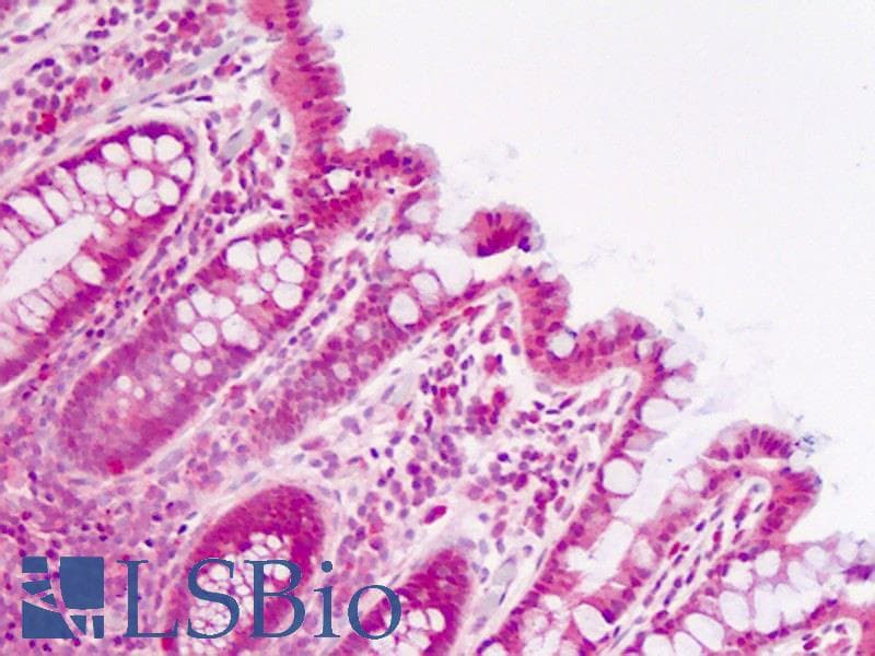 IHC-plus™ PBK / TOPK Antibody (aa286-317)