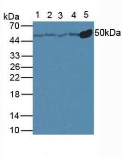 TUBB / Beta Tubulin Antibody (FITC)