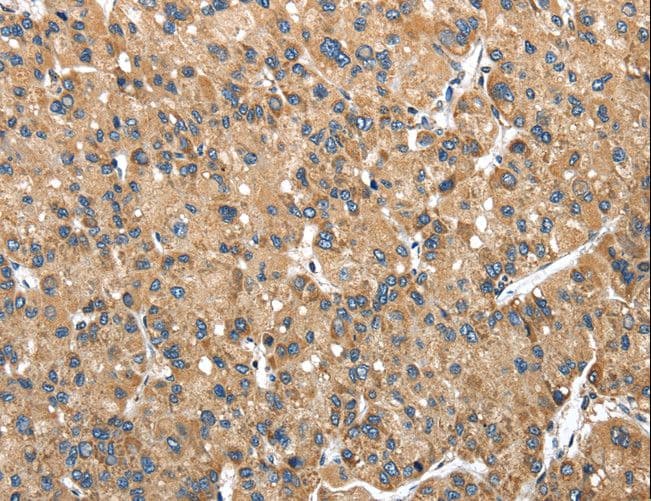 NDUFA5 Antibody