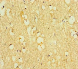 Polyclonal Rabbit anti-Human TNRC9 / TOX3 Antibody (IHC, IF, WB)