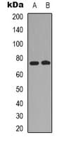 IHC-plus™ Polyclonal Rabbit anti-Human RAF1 / RAF Antibody (C-Terminus, IHC, IF, WB)