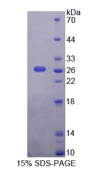 Human KATII / AADAT Protein (Recombinant His-T7, N-terminus)